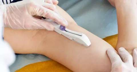 Contraceptive Implant vs. Birth Control Pill: Which Is Right for You?